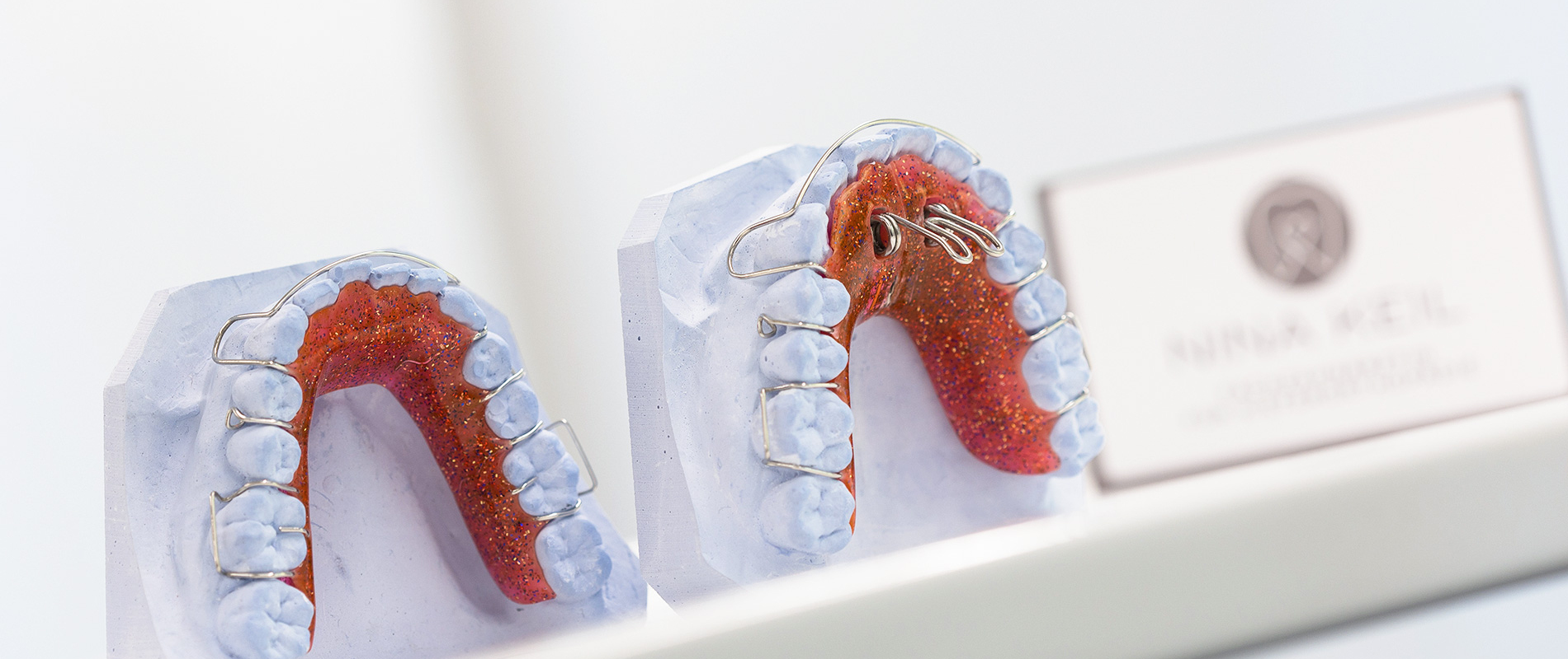 Gipsmodell mit herausnehmbarer Zahnspange