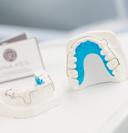 Herausnehmbare Spange auf Gipsmodell