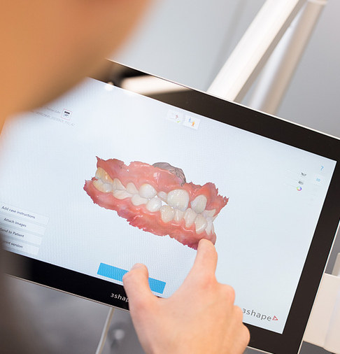 3D-Scan abgebildet auf einem Monitor