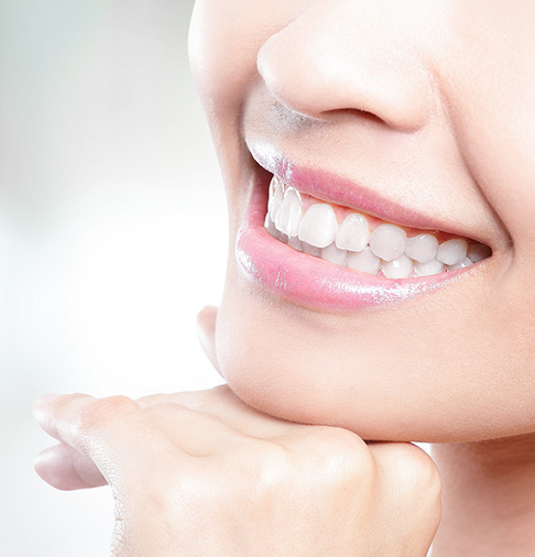 Aufnahme des lachenden Mundbereichs einer Dame mit strahlend weißen Zähnen